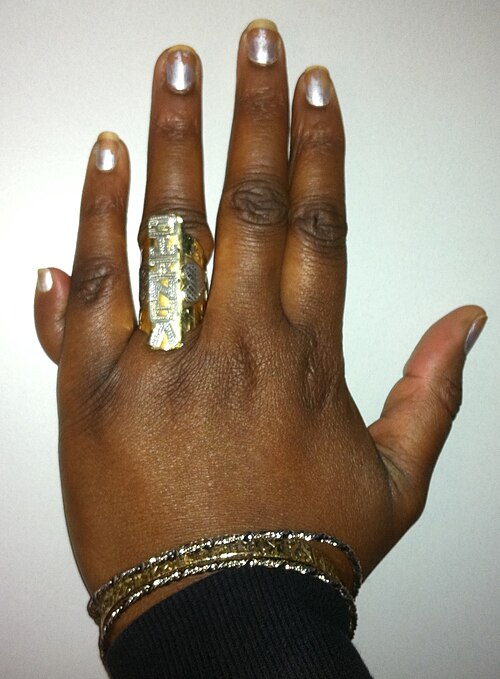 six fingers - polydactyl